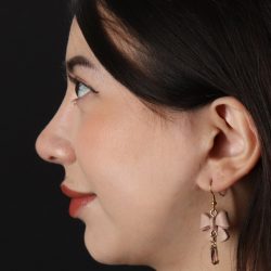 Rhinoplasty Before & After Patient #3159