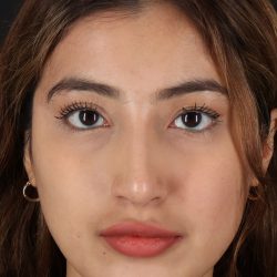 Liquid Rhinoplasty Before & After Patient #2254