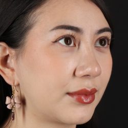 Rhinoplasty Before & After Patient #3159