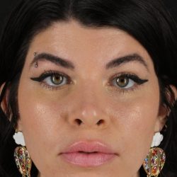Browlift Before & After Patient #1220