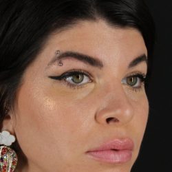 Browlift Before & After Patient #1220