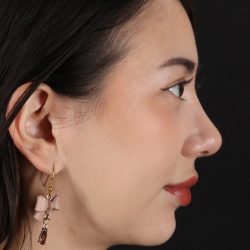 Rhinoplasty Before & After Patient #3159