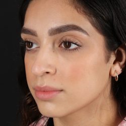 Rhinoplasty Before & After Patient #3269
