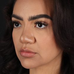 Rhinoplasty Before & After Patient #3192