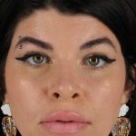 Browlift Before & After Patient #1220