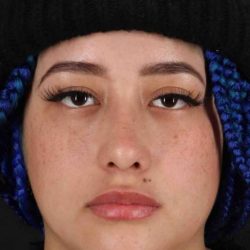 Rhinoplasty Before & After Patient #3016