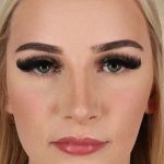 Browlift Before & After Patient #1242