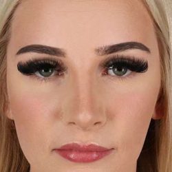 Browlift Before & After Patient #1242
