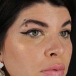 Browlift Before & After Patient #1220