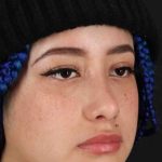 Rhinoplasty Before & After Patient #3016