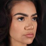 Rhinoplasty Before & After Patient #3192