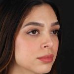 Rhinoplasty Before & After Patient #3269