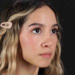 Rhinoplasty Before & After Patient #3302