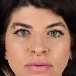 Browlift Before & After Patient #1220