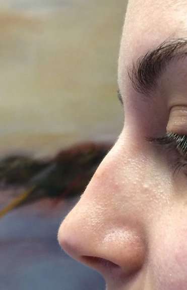 Liquid Rhinoplasty Before & After Patient #2293