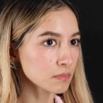 Rhinoplasty Before & After Patient #3302