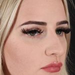 Browlift Before & After Patient #1242
