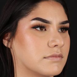 Rhinoplasty Before & After Patient #5574