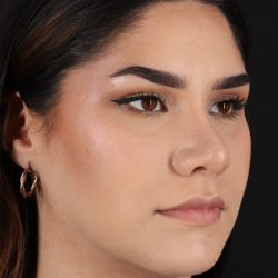 Rhinoplasty Before & After Patient #5574